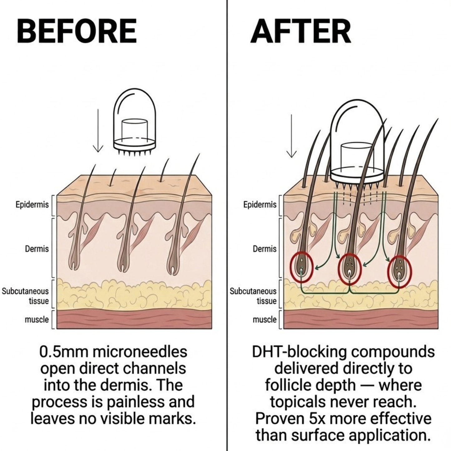 RootInfuse Hair Regrowth System
