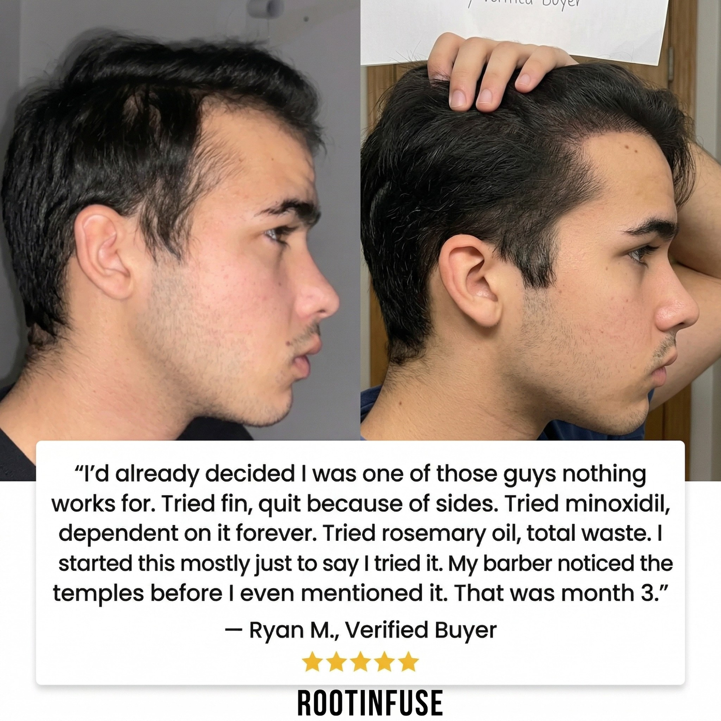 RootInfuse Hair Regrowth System